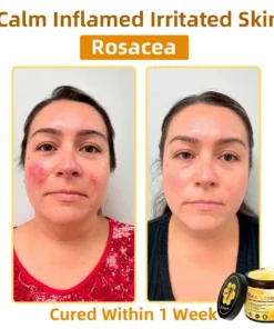 STDEI® APIS VENENUMREPAIR BALM