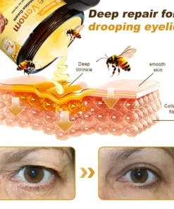 STDEI® APIS VENENUMREPAIR BALM