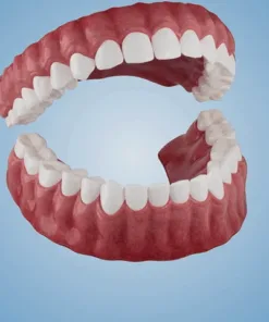 TAILEDEN™-New Generation Flexible Full Denture Solution