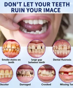 TAILEDEN™-New Generation Flexible Full Denture Solution