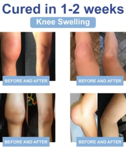 TAILEDEN™ Official Store: Magnesium Pain Healing Bone Cream