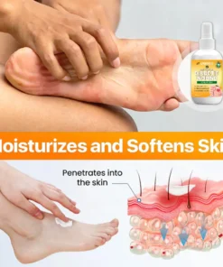 UNPREE™ Bee Venom Diabetic Wound Kolirin Spray