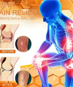 VENOLYX™ Bee Venom Rapid Therapy Joint Cream