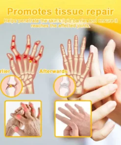 XRLXRL™ Bee Venom Pain-Relief Bone Healing Cream