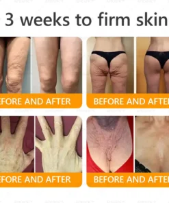 APKAPK® Bee venom Comprehensive Cream