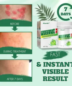 Alisanda™ Herbal Tinealess Cream