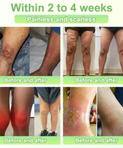 COROU® Natural Herbal Tourmaline Far Infrared Magnetic Therapy Foot Patches