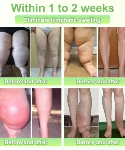 COROU® Natural Herbal Tourmaline Far Infrared Magnetic Therapy Foot Patches