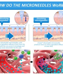CROAIE® 🌱Nano Microneedle Patch with SMGT-GLP-1 & Matrixyl 3000 – Slimming, Skin Tightening, Blood Sugar Support, No Injection, 7-Day Result