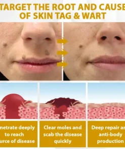 Cheemex™ CastorBee Tag & Spots Peel-Off Mask