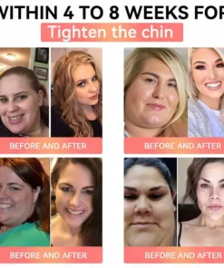 Cheemex™ GLP-1 High-Concentration Liquid Pearls