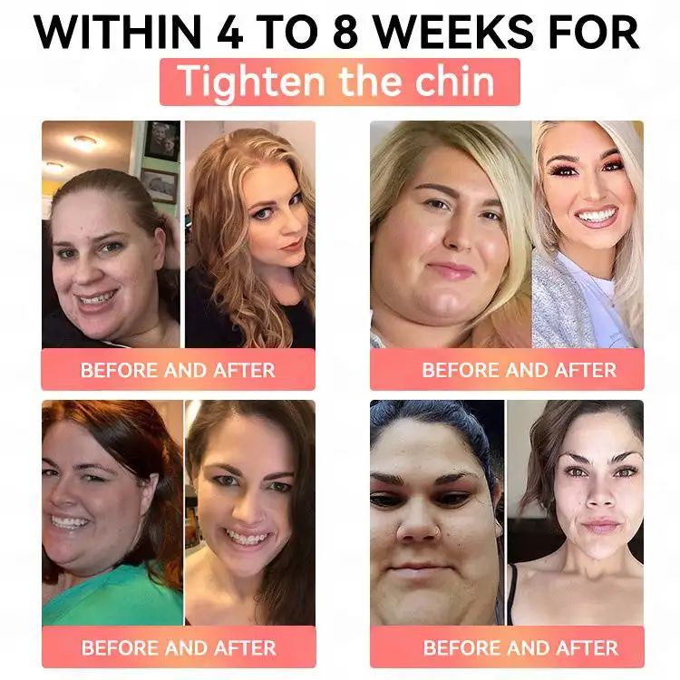 Cheemex™ GLP-1 High-Concentration Liquid Pearls