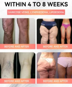 Cheemex™ GLP-1 High-Concentration Liquid Pearls