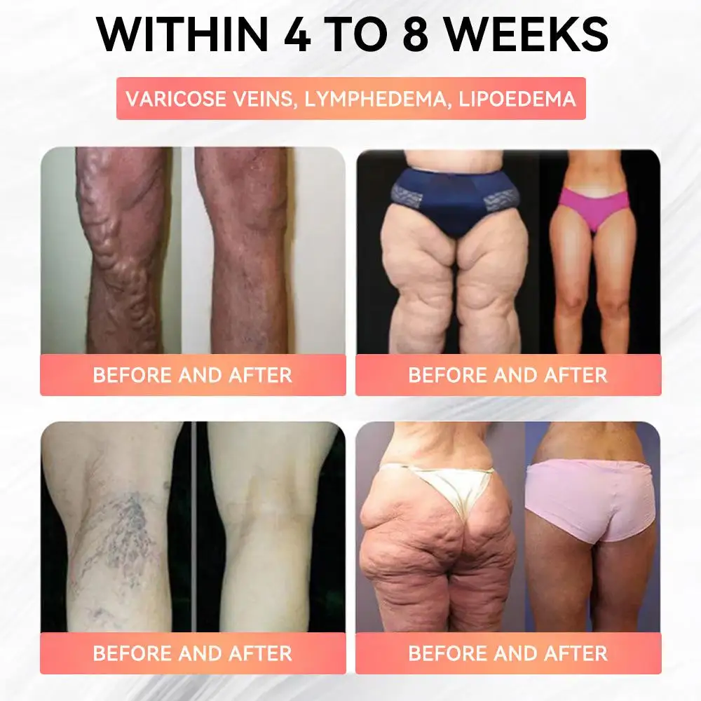 Cheemex™ GLP-1 High-Concentration Liquid Pearls