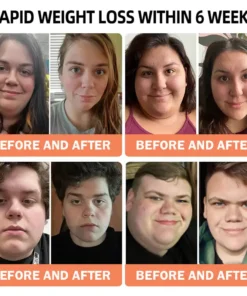 Croaie® Apamin GLP-1 Lymphatic Drainage Slimming Nano Microneedle Patch