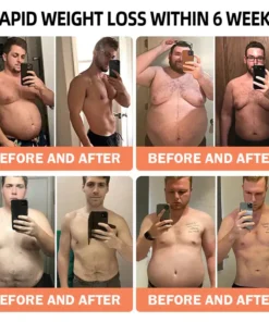 Croaie® Apamin GLP-1 Lymphatic Drainage Slimming Nano Microneedle Patch