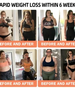 Croaie® Apamin GLP-1 Lymphatic Drainage Slimming Nano Microneedle Patch