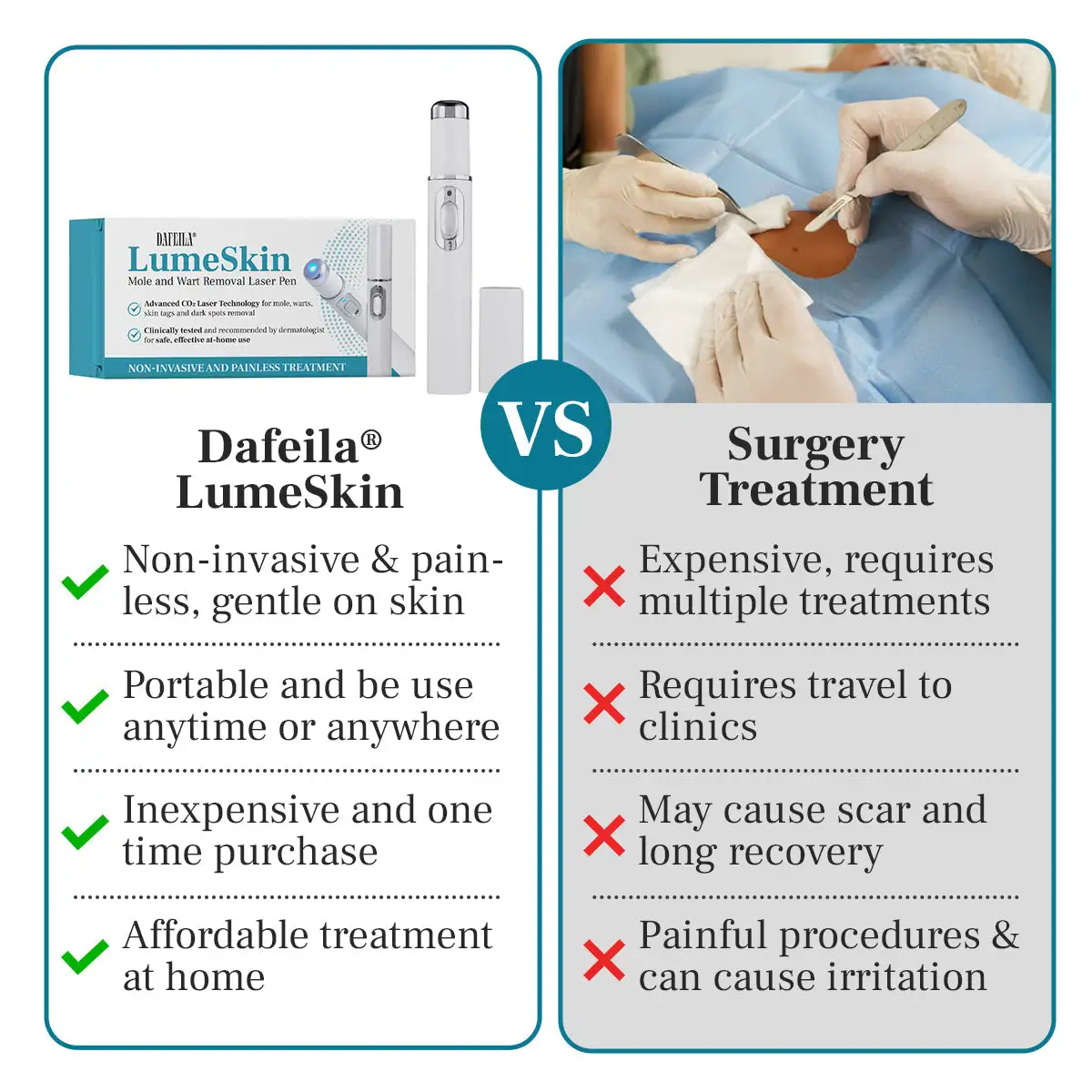 DAFEILA® LumeSkin Mole and Wart Removal Laser Pen