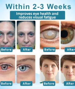 Jaxvolt™ Clarity Care Advanced Eye Drops