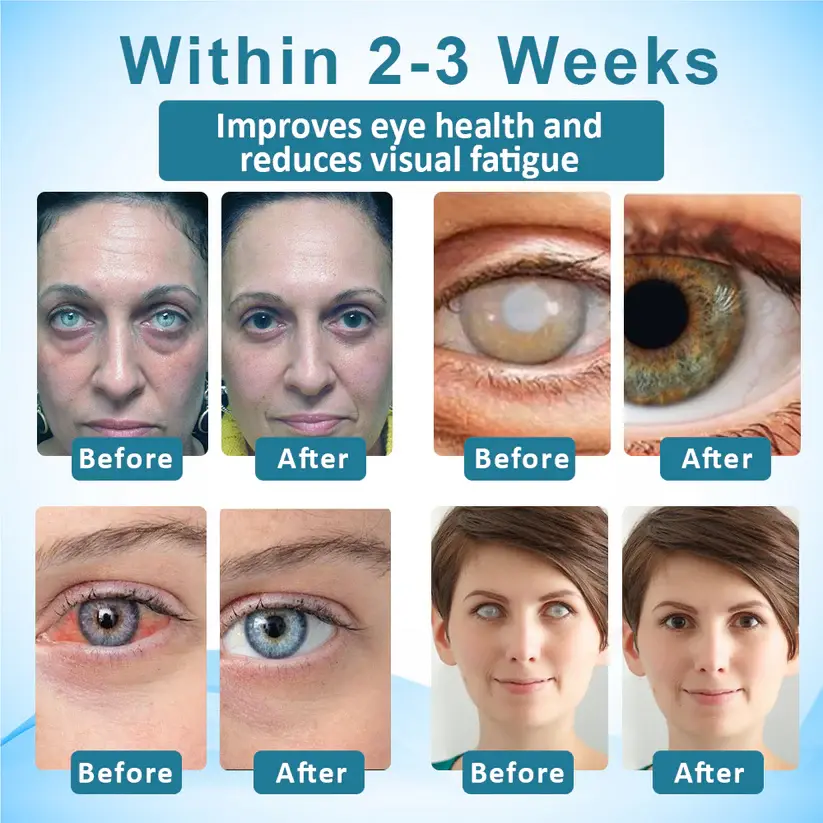 Jaxvolt™ Clarity Care Advanced Eye Drops