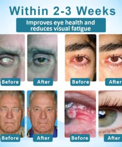 Jaxvolt™ Clarity Care Advanced Eye Drops