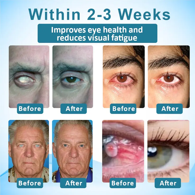 Jaxvolt™ Clarity Care Advanced Eye Drops