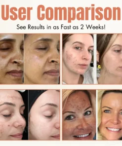 LuxeTone™ Melanin Correcting Facial Serum