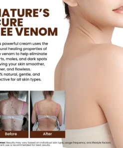 Lyyeto® Bee Venom Skin Treatment Cream