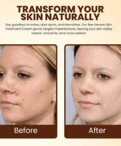 Lyyeto® Bee Venom Skin Treatment Cream