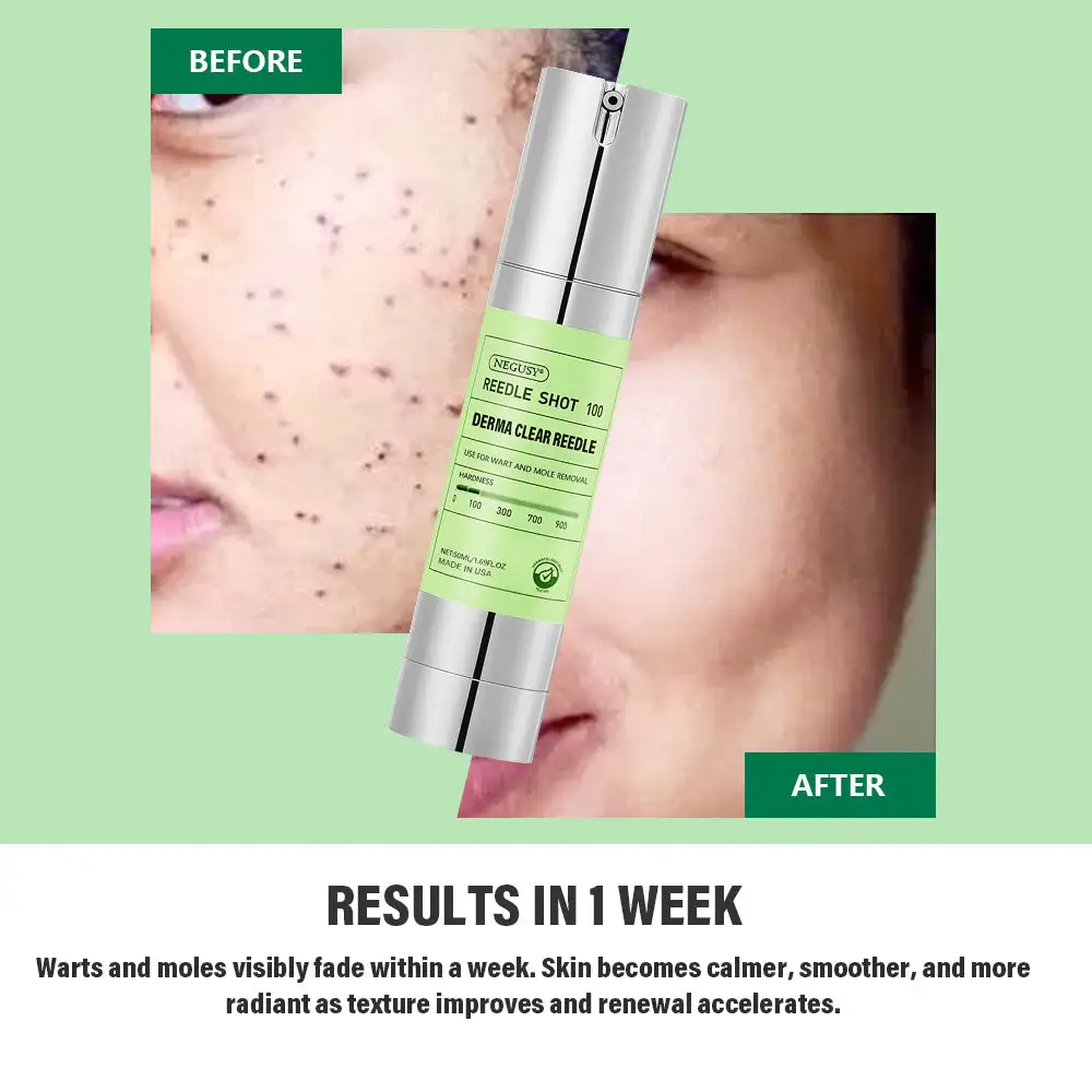 NEGUSY® USA DermaClear Reedle Shot 100 Wart & Mole Eraser Serum
