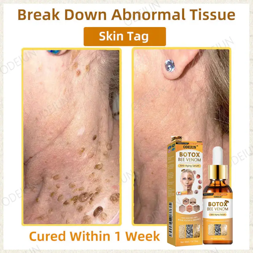 ODEIUN™ BOTOX Bee Venom Anti-Aging Serum