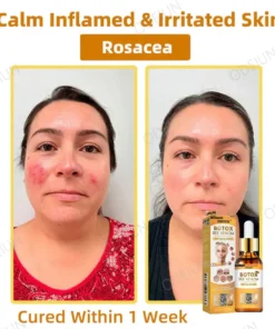 ODEIUN™ BOTOX Bee Venom Anti-Aging Serum