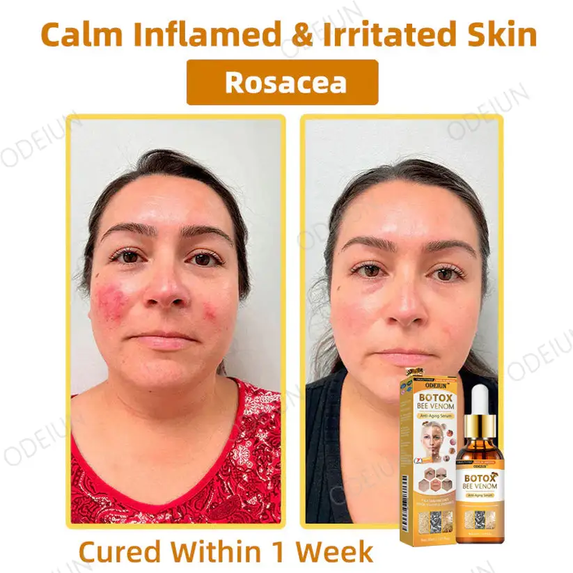 ODEIUN™ BOTOX Bee Venom Anti-Aging Serum