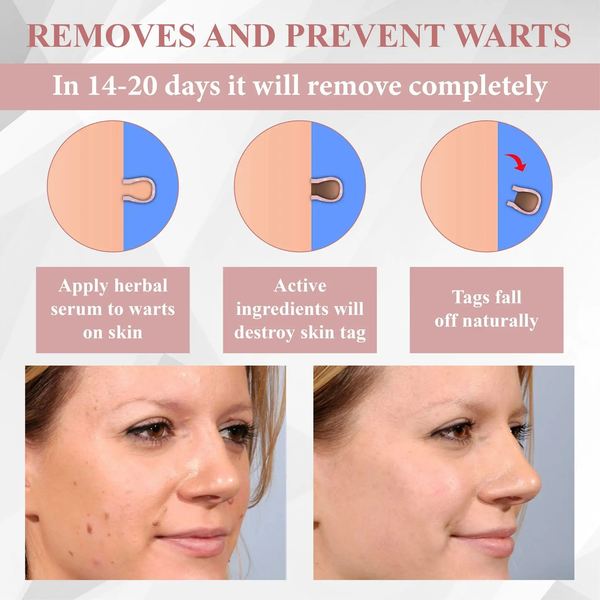 ODEIUN® Tag & Blemish Peel-Off Gel Wrapping Mask