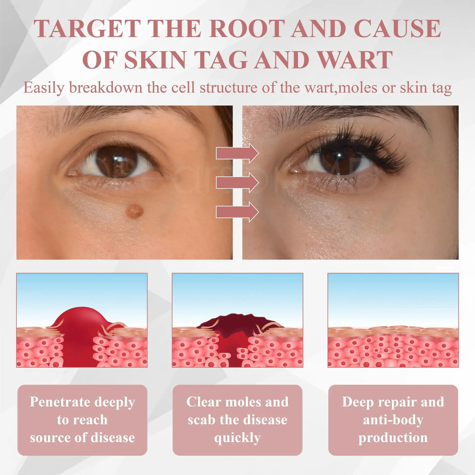 ODEIUN® Tag & Blemish Peel-Off Gel Wrapping Mask