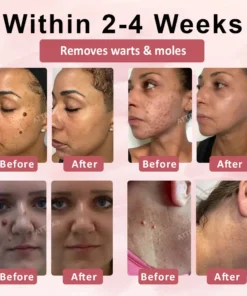 ODEIUN® Tag & Blemish Peel-Off Gel Wrapping Mask