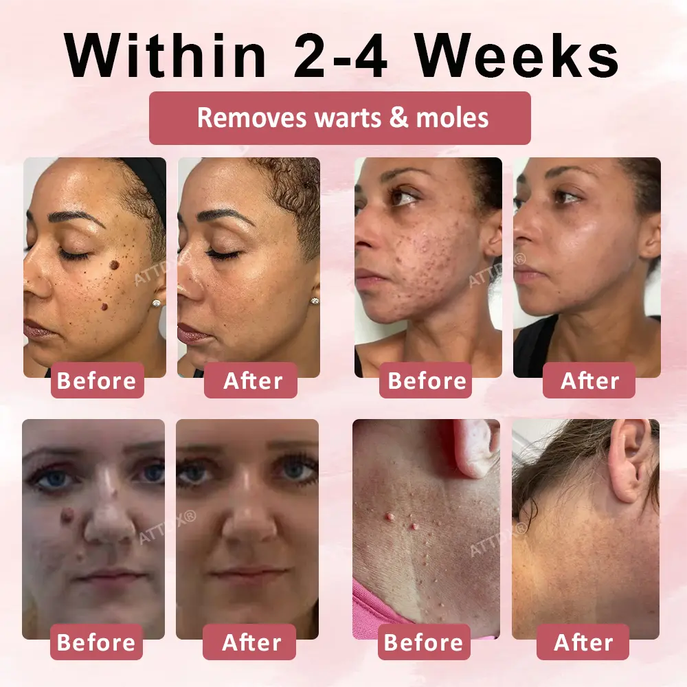 ODEIUN® Tag & Blemish Peel-Off Gel Wrapping Mask