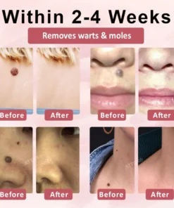 ODEIUN® Tag & Blemish Peel-Off Gel Wrapping Mask