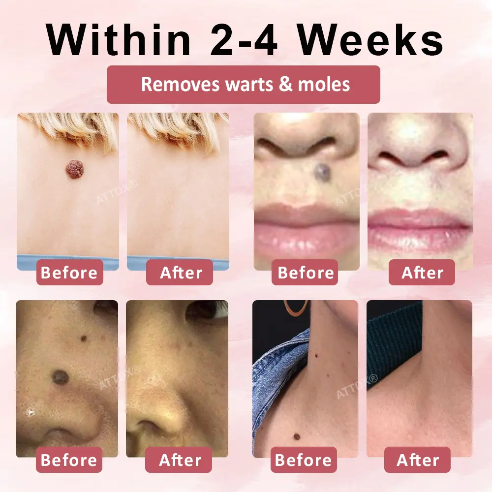 ODEIUN® Tag & Blemish Peel-Off Gel Wrapping Mask