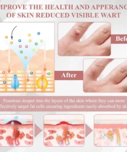 ODEIUN® Tag & Blemish Peel-Off Gel Wrapping Mask