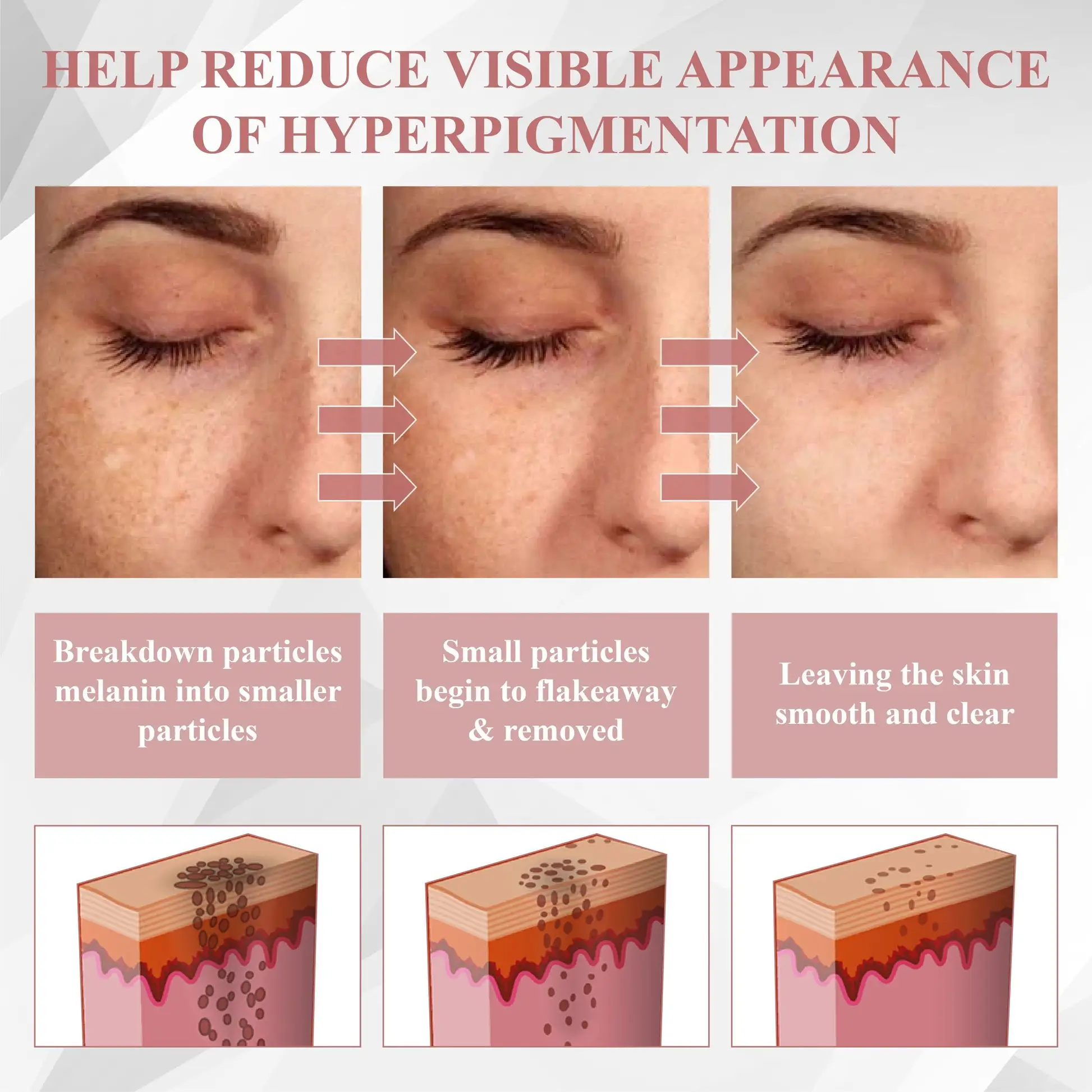 ODEIUN® Tag & Blemish Peel-Off Gel Wrapping Mask