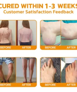 PolarFresh® Magnesium Oil & Bee Venom Pain-Relief Bone Healing Cream