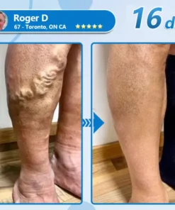 СΟRΟU® GLP-1 Nаnо Mісrоnееdlе Раtсh