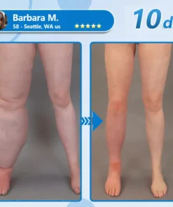 СΟRΟU® GLP-1 Nаnо Mісrоnееdlе Раtсh