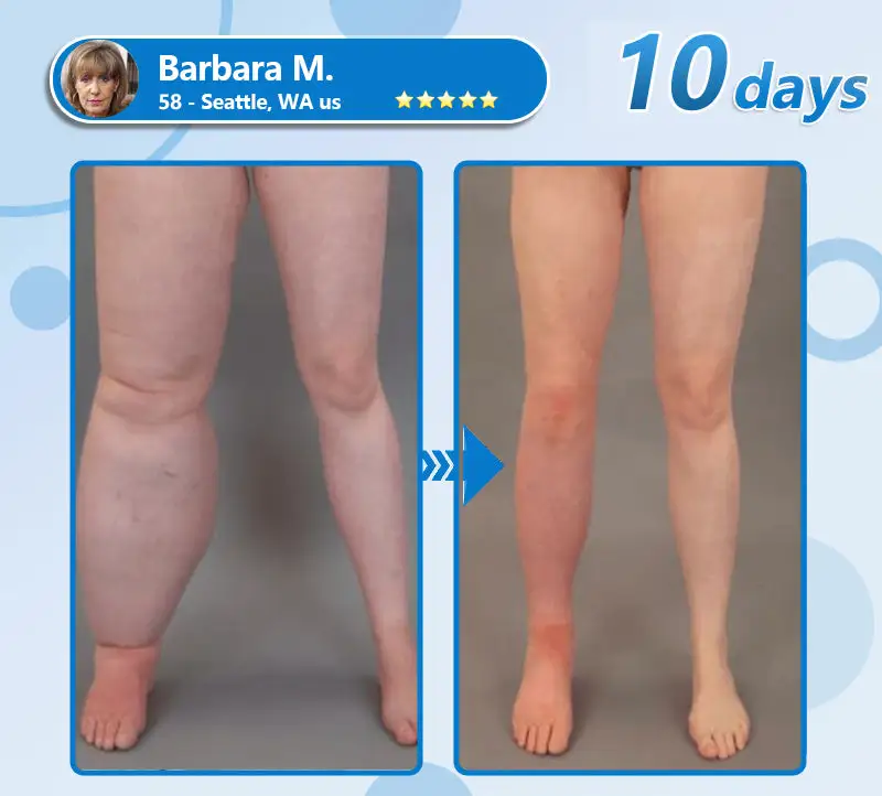 СΟRΟU® GLP-1 Nаnо Mісrоnееdlе Раtсh