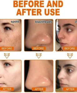 Slimoly™ Whitening and Freckle - Removing Mask