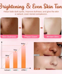 Slimoly™ Whitening and Freckle - Removing Mask