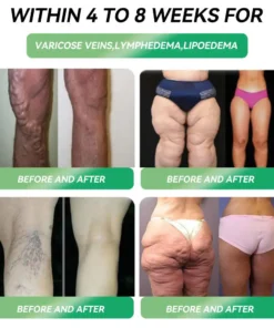 𝐖𝐚𝐫𝐦𝐅𝐚𝐦𝐢𝐥𝐲® 𝐆𝐋𝐏-𝟏 𝐖𝐞𝐢𝐠𝐡𝐭 𝐋𝐨𝐬𝐬 𝐎𝐫𝐚𝐥 𝐒𝐨𝐥𝐮𝐭𝐢𝐨𝐧