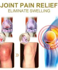 𝑹𝒂𝒊𝒏𝒅𝒆𝒘® 𝑩𝑬𝑬 𝑽𝑬𝑵𝑶𝑴 𝑱𝑶𝑰𝑵𝑻 𝑹𝑬𝑳𝑰𝑬𝑭 𝑩𝑨𝑳𝑴