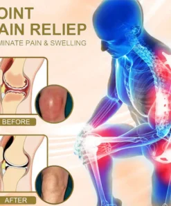 𝑹𝒂𝒊𝒏𝒅𝒆𝒘® 𝑩𝑬𝑬 𝑽𝑬𝑵𝑶𝑴 𝑱𝑶𝑰𝑵𝑻 𝑹𝑬𝑳𝑰𝑬𝑭 𝑩𝑨𝑳𝑴